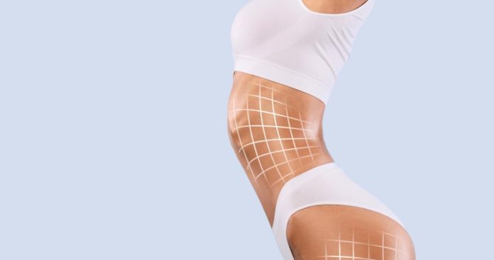 Lipo com tecnologias indica avanço na cirurgia plástica