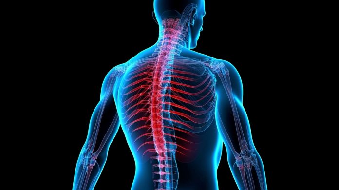 Técnicas minimamente invasivas tratam dores na coluna Técnicas minimamente invasivas tratam dores na coluna