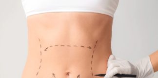 Avanços técnicos ajudam a reduzir cicatrizes cirúrgicas Avanços técnicos ajudam a reduzir cicatrizes cirúrgicas