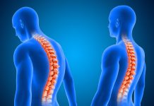 Cirurgia de escoliose é a 1ª com neuronavegação em Uberlândia