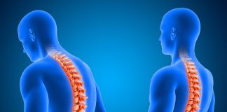 Cirurgia de escoliose é a 1ª com neuronavegação em Uberlândia Cirurgia de escoliose é a 1ª com neuronavegação em Uberlândia