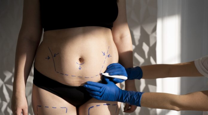 Exposição solar exige cuidados específicos antes e após cirurgias plásticas Exposição solar exige cuidados específicos antes e após cirurgias plásticas