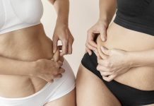 Lipoaspiração exige cuidados médicos rigorosos, alerta especialista