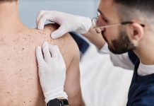 Desinformação e estigmas sobre a hanseníase atrasam cuidados