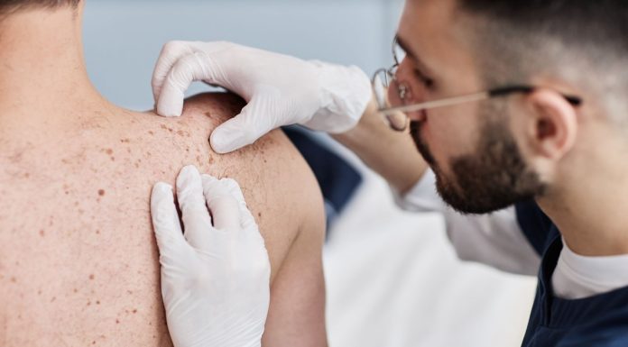 Desinformação e estigmas sobre a hanseníase atrasam cuidados Desinformação e estigmas sobre a hanseníase atrasam cuidados