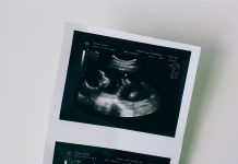 Cirurgia fetal minimamente invasiva tem resultado promissor