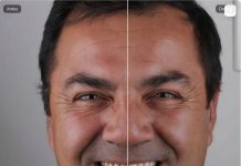 Tecnologia ajuda dentistas a prever resultados estéticos Tecnologia ajuda dentistas a prever resultados estéticos