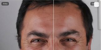 Tecnologia ajuda dentistas a prever resultados estéticos