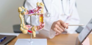 Campanha Março Azul alerta para o câncer colorretal