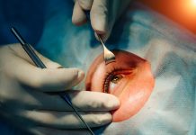 Cirurgia de catarata evolui e amplia recuperação da visão