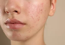 Especialista explica os efeitos do chocolate no organismo