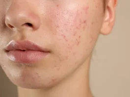 Especialista explica os efeitos do chocolate no organismo