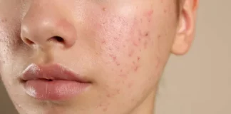 Especialista explica os efeitos do chocolate no organismo