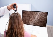 Tratamentos capilares ganham novas tecnologias
