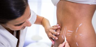 Lipo HD amplia possibilidades da definição corporal