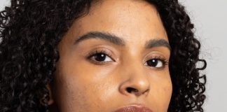 Mês de Conscientização da Acne incentiva cuidados especiais