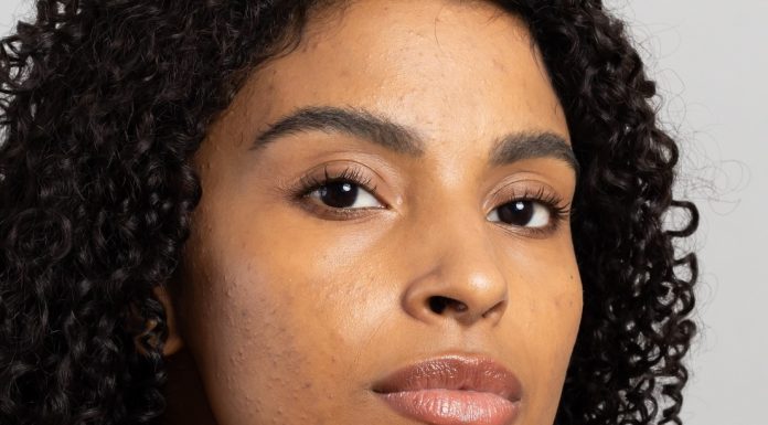 Mês de Conscientização da Acne incentiva cuidados especiais