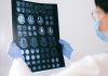 BrainAge: tecnologia indica a idade cerebral BrainAge: tecnologia indica a idade cerebral