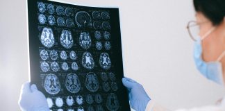 BrainAge: tecnologia indica a idade cerebral
