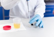 Novo exame analisa exposição hormonal feminina