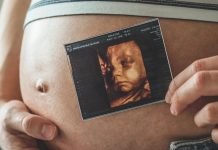 Ultrassonografia obstétrica avança no diagnóstico pré-natal Ultrassonografia obstétrica avança no diagnóstico pré-natal