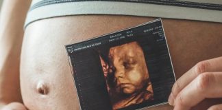 Ultrassonografia obstétrica avança no diagnóstico pré-natal