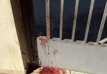 Moradora relata ataque de pitbull a cachorro dentro de residência em Botucatu