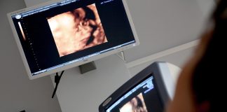Pesquisa reforça técnica fetal para hérnia diafragmática Pesquisa reforça técnica fetal para hérnia diafragmática