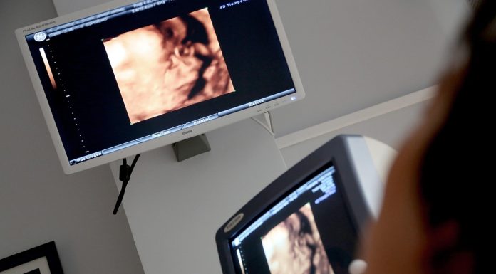 Pesquisa reforça técnica fetal para hérnia diafragmática