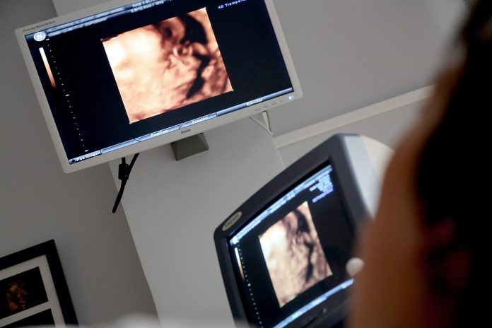 Pesquisa reforça técnica fetal para hérnia diafragmática Pesquisa reforça técnica fetal para hérnia diafragmática