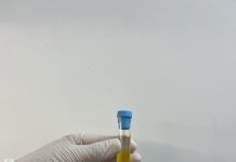 CFM regulamenta PRP em condições osteomusculares