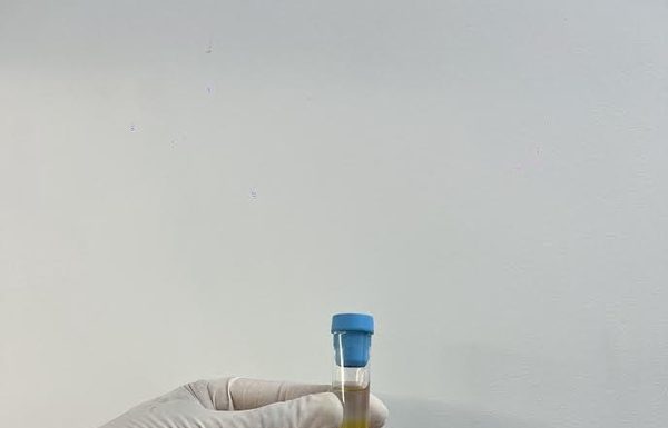 CFM regulamenta PRP em condições osteomusculares
