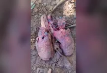 Polícia Civil de Botucatu investiga origem de órgão encontrado em quintal da região