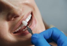 Falha em tratamento dentário nem sempre indica erro
