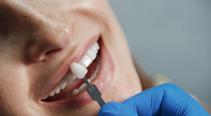 Falha em tratamento dentário nem sempre indica erro