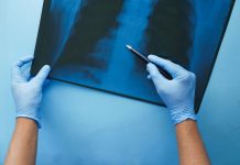 CONITEC abre consulta para Hipertensão Arterial Pulmonar