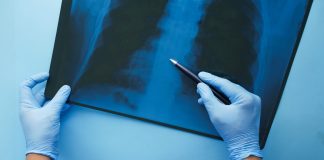 CONITEC abre consulta para Hipertensão Arterial Pulmonar CONITEC abre consulta para Hipertensão Arterial Pulmonar