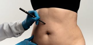 Lipoaspiração lidera preferência por cirurgias plásticas Lipoaspiração lidera preferência por cirurgias plásticas
