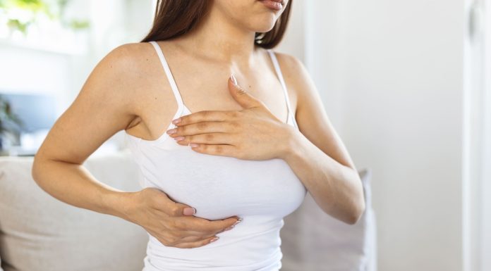 Nem toda mulher com câncer de mama se beneficia da quimio Nem toda mulher com câncer de mama se beneficia da quimio