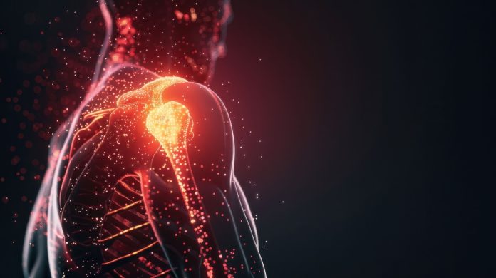Novos procedimentos tratam a dor no ombro sem cirurgia