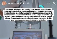 Laser de CO2 Neoxel ganha destaque com Xuxa