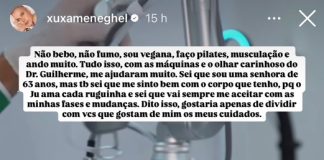 Laser de CO2 Neoxel ganha destaque com Xuxa Laser de CO2 Neoxel ganha destaque com Xuxa