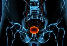 Urologista explica diferenças entre HPB e câncer de próstata