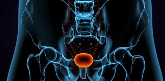 Urologista explica diferenças entre HPB e câncer de próstata