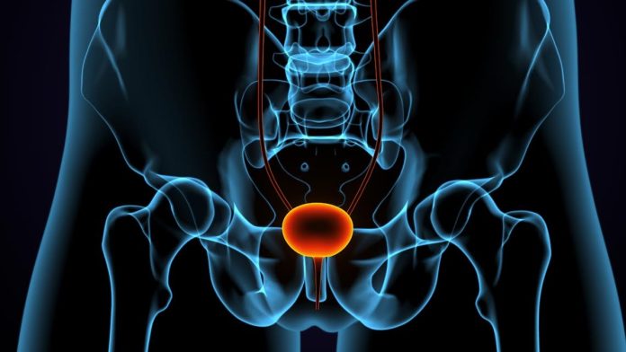 Urologista explica diferenças entre HPB e câncer de próstata