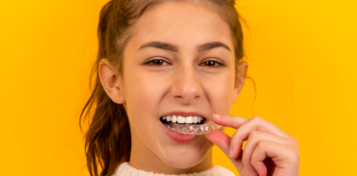 Alinhador invisível: como funciona o tratamento dentário