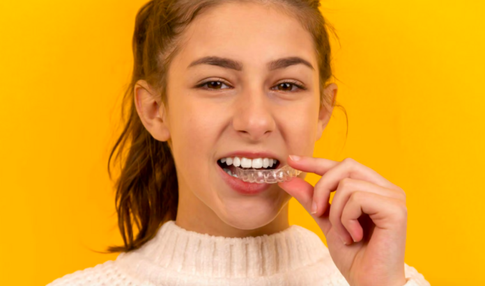 Alinhador invisível: como funciona o tratamento dentário Alinhador invisível: como funciona o tratamento dentário