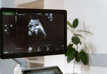 Vilo corial tem diagnóstico genético precoce