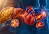 Avanço da esteatose hepática acende alerta