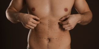Definição em foco: a evolução da lipoaspiração masculina